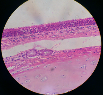 ciliated cell
