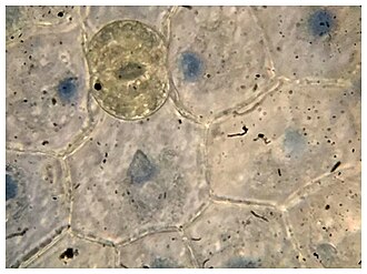 stoma