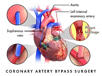 coronary artery