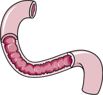 duodenum