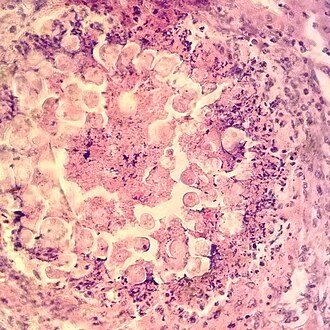 small intestine