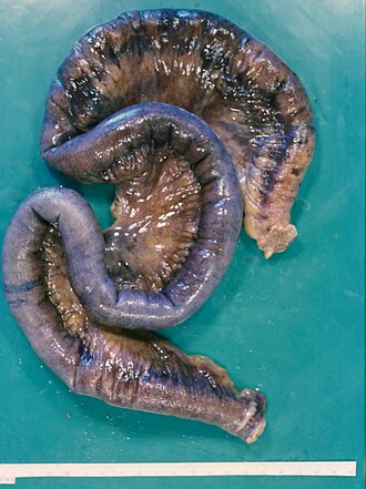 ileum