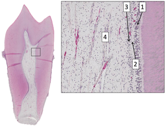 pulp cavity