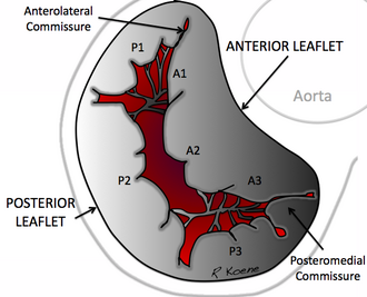 Bicuspid valve