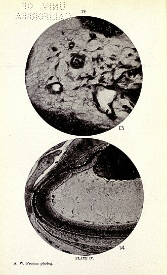 Vitreous humour