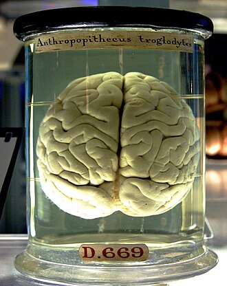 brain