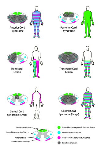 spinal cord