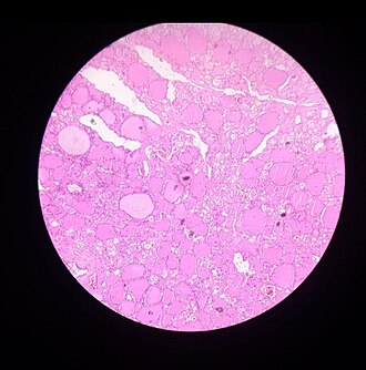 Thyroid gland