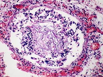 Amniotic fluid