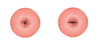 Cervix