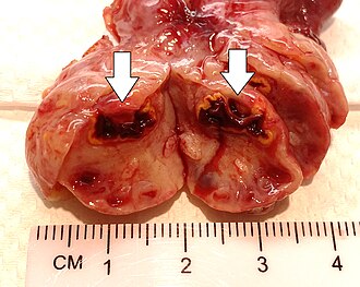 Corpus luteum