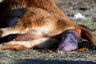 Amniotic sac