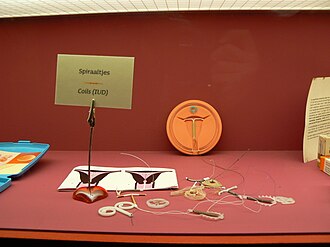 Intra-uterine device