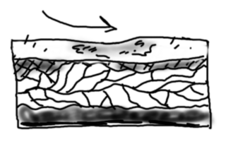 Abrasion