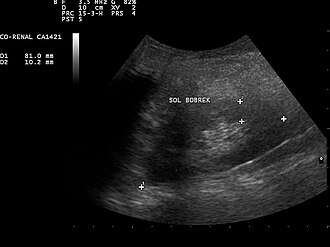 ultrasound