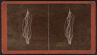 electric current